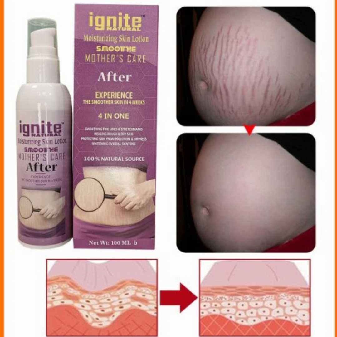 Ignite,Mother,Care,Lotion