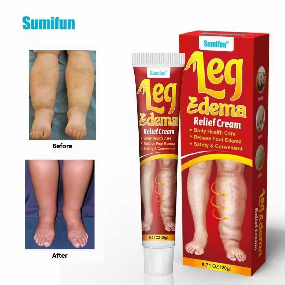 Sumifun,Leg,Edema,Relief,cream